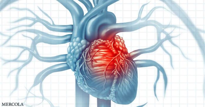 Study: Long-Term Pain Post-Heart Attack May Be an Earlier Death Signal