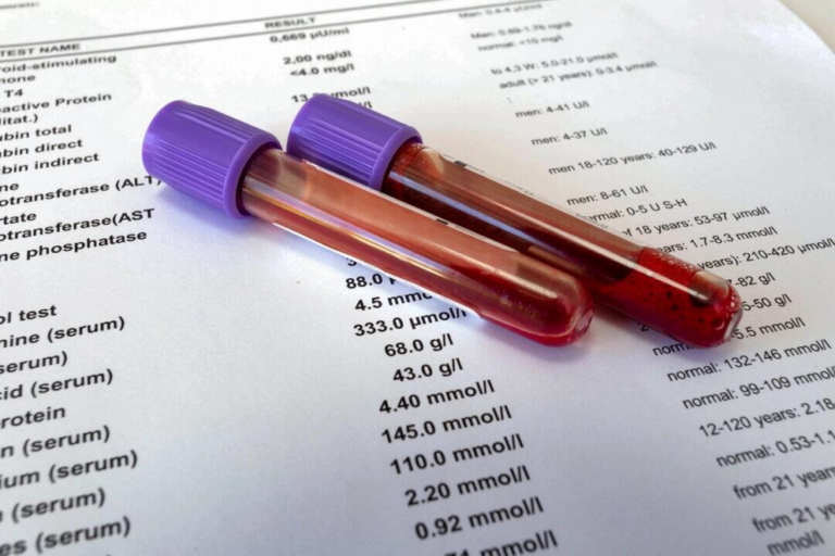 Understanding lab tests for optimal health